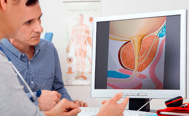Diagnose von Prostatitis