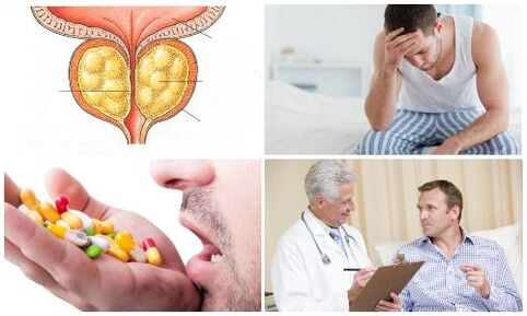 Prostatitis bei Männern