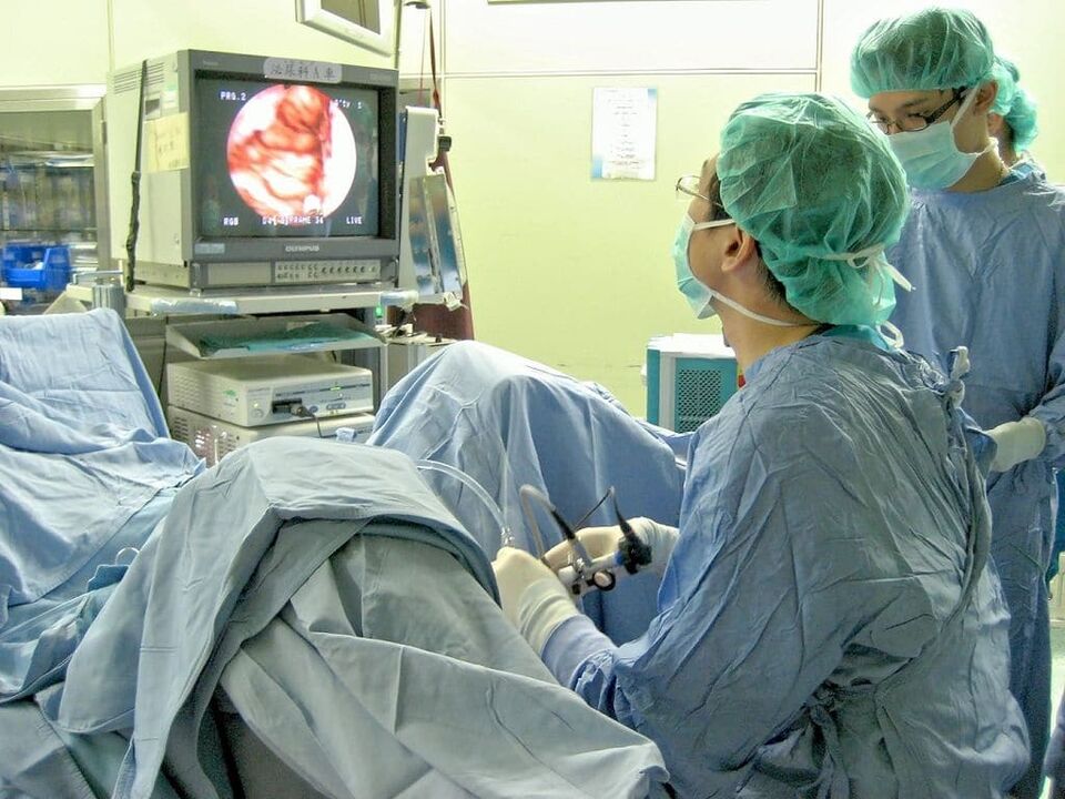 chirurgische Behandlung von Prostatitis-Steinen